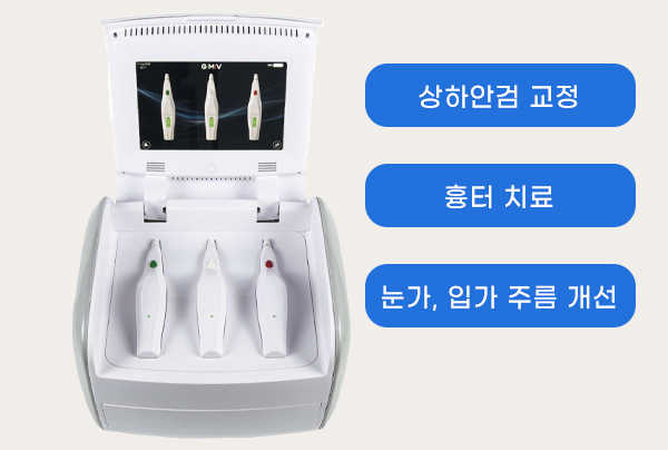 프렉사레이저